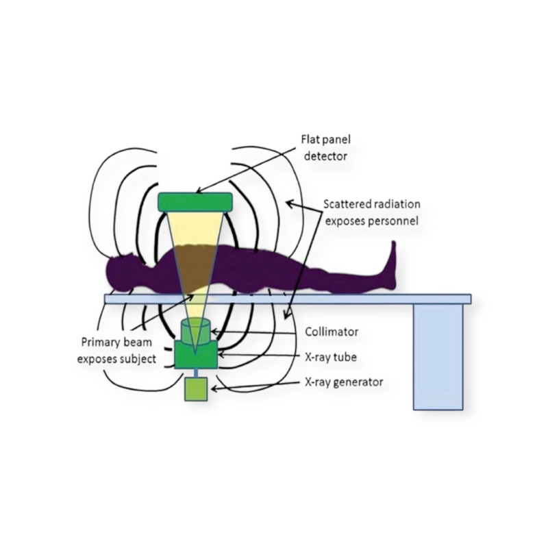 A diagram illustrating the radiation field around the equipment, patient and personnel.