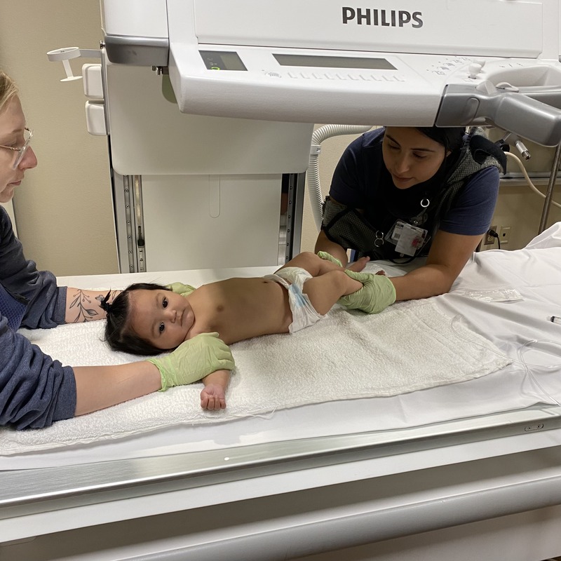 Radiation exposure to the technologist’s hands during the procedure.